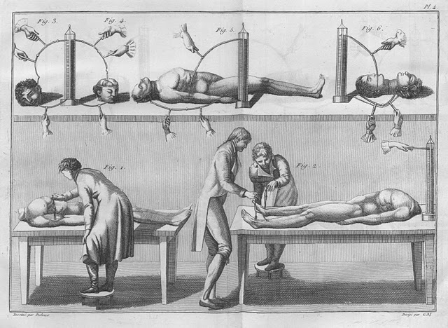 Esperimenti di Giovanni Aldini sui cadaveri - immagine: pubblico dominio